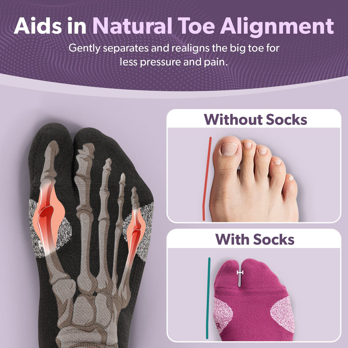 Bunion Relief Socks (1 Pair) - Split-Toe Compression Socks for Cushioned Bunion Support and Hallux Valgus Pain Relief