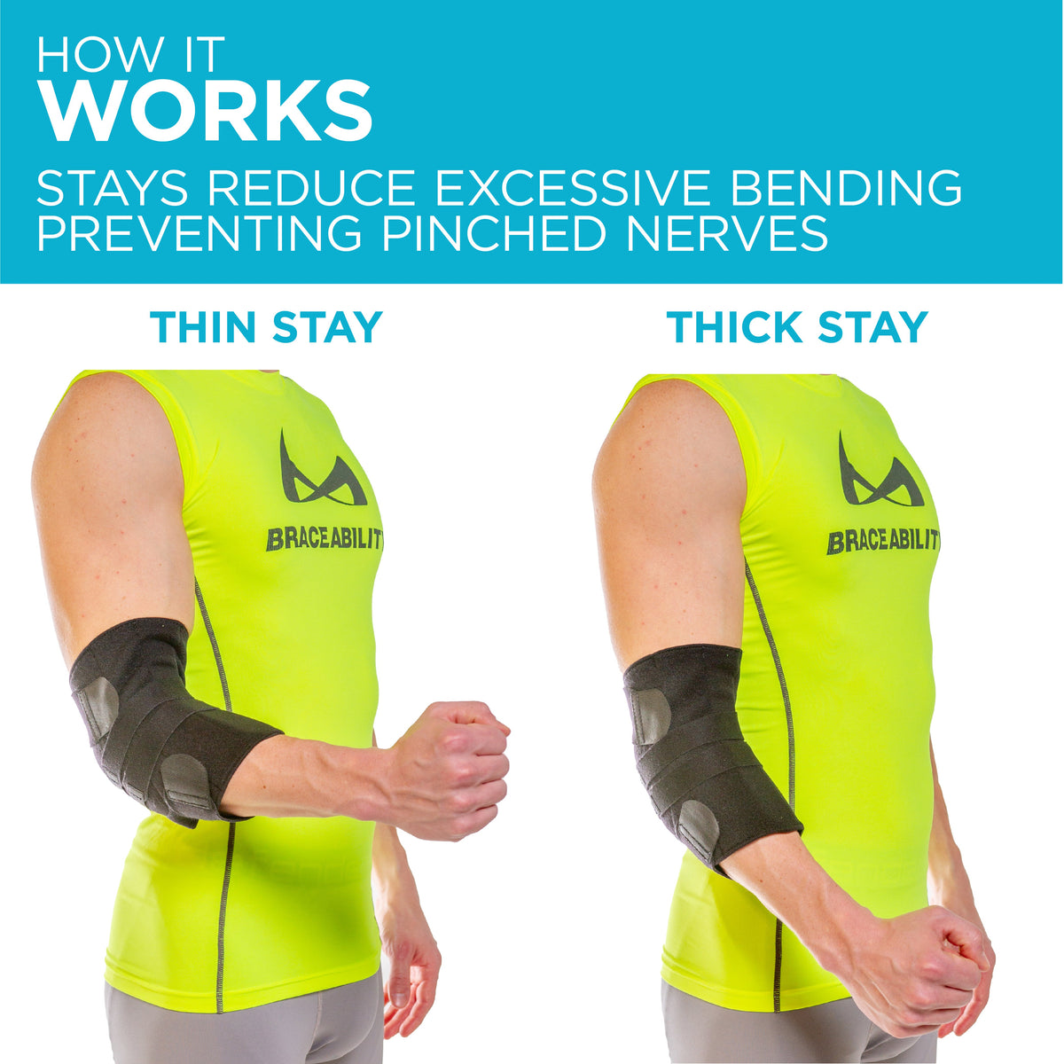Cubital Tunnel Syndrome Brace | Elbow Splint for Radial or Ulnar Nerve Entrapment Treatment